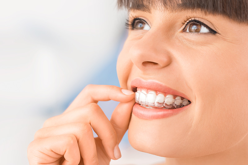 Invisalign in Concord